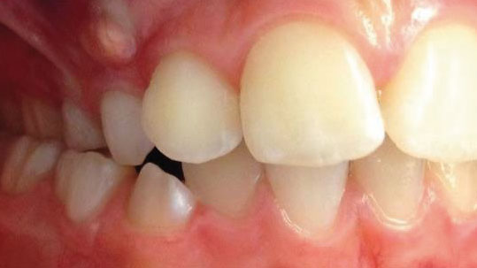 Scopri di più sull'articolo Caso clinico con Equilibratore